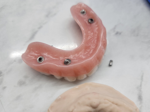 Why Do People Choose Dental Implants Brisbane Over Dentures Today